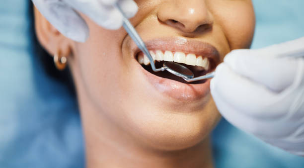 Best Emergency Tooth Extraction in Saddle River, NJ